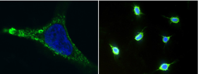 CD146 Antibody in Immunocytochemistry (ICC/IF)