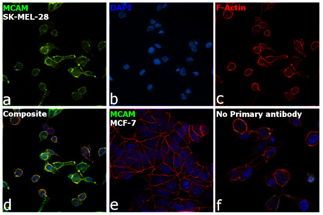 CD146 Antibody in Immunocytochemistry (ICC/IF)