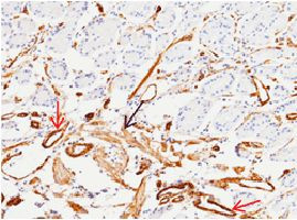 CD146 Antibody in Immunohistochemistry (Paraffin) (IHC (P))