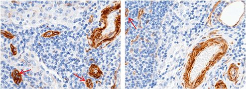 CD146 Antibody in Immunohistochemistry (Paraffin) (IHC (P))