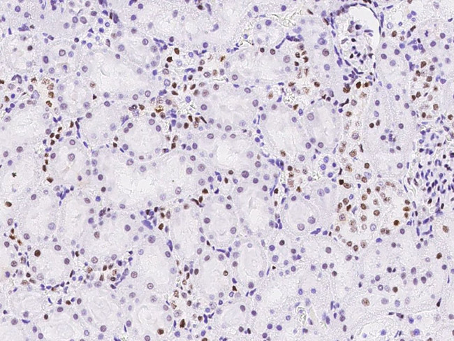 MSH6 Antibody in Immunohistochemistry (Paraffin) (IHC (P))