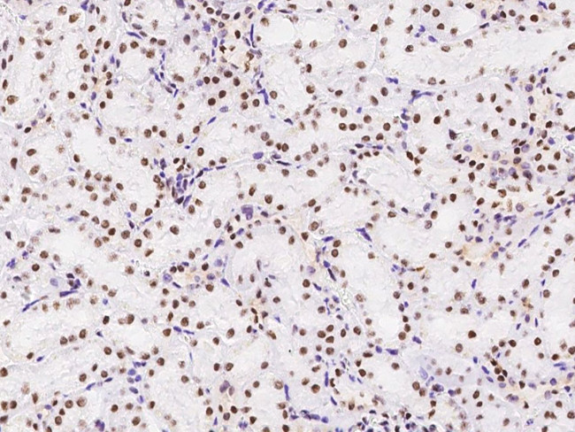 MSH6 Antibody in Immunohistochemistry (Paraffin) (IHC (P))