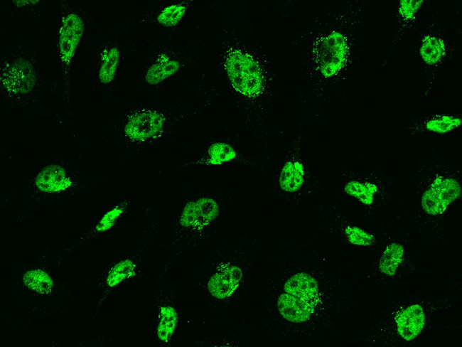 MSH6 Antibody in Immunocytochemistry (ICC/IF)