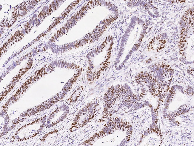 MSH6 Antibody in Immunohistochemistry (Paraffin) (IHC (P))