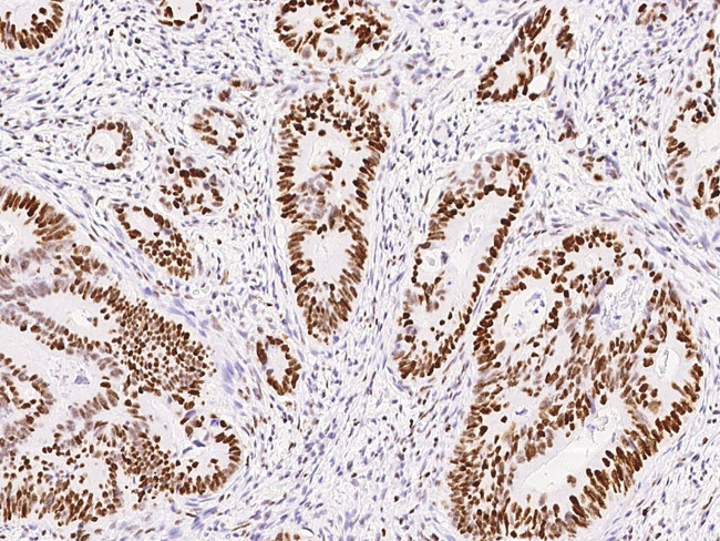 MSH6 Antibody in Immunohistochemistry (Paraffin) (IHC (P))