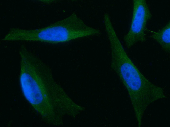 ARD1A Antibody in Immunocytochemistry (ICC/IF)