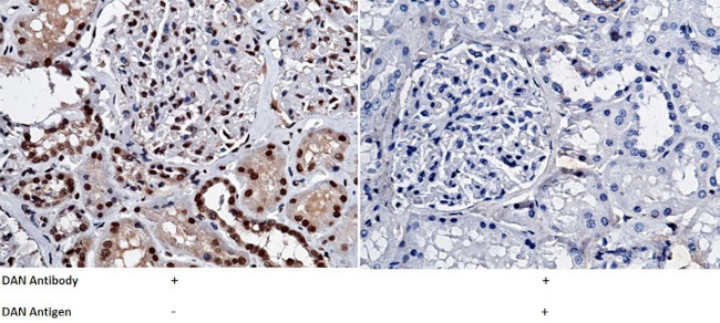 NBL1 Antibody in Immunohistochemistry (Paraffin) (IHC (P))