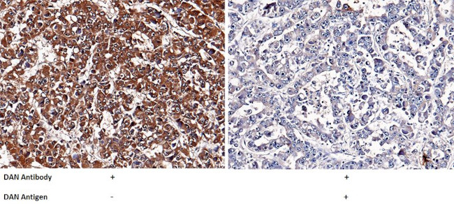 NBL1 Antibody in Immunohistochemistry (Paraffin) (IHC (P))