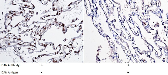 NBL1 Antibody in Immunohistochemistry (Paraffin) (IHC (P))