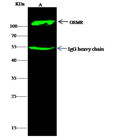 OSMR Antibody in Immunoprecipitation (IP)