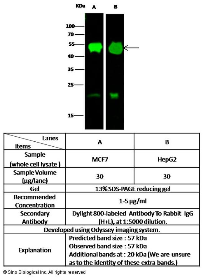 PDI Antibody in Western Blot (WB)