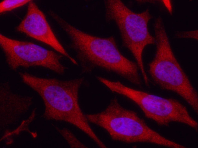 DJ-1 Antibody in Immunocytochemistry (ICC/IF)