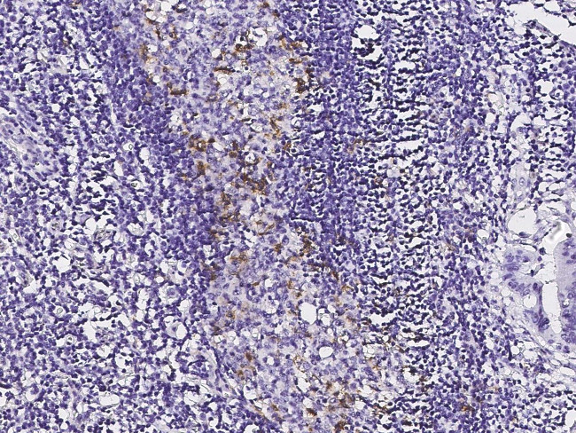 PD-1 Antibody in Immunohistochemistry (Paraffin) (IHC (P))