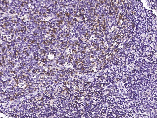 PD-1 Antibody in Immunohistochemistry (Paraffin) (IHC (P))