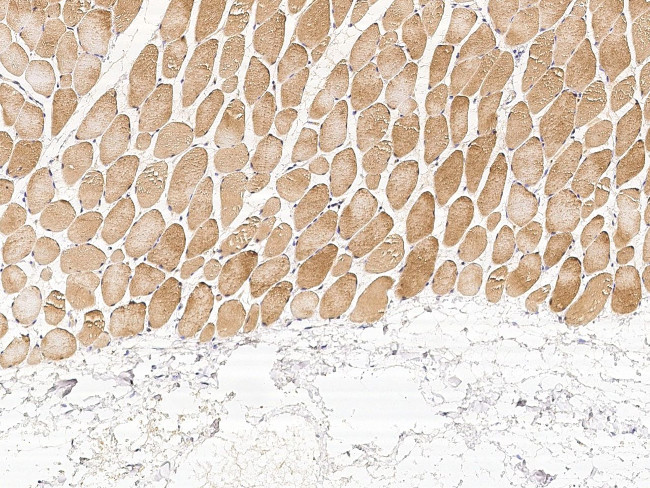 PHPT1 Antibody in Immunohistochemistry (Paraffin) (IHC (P))