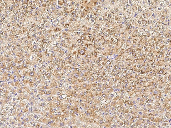 PMVK Antibody in Immunohistochemistry (Paraffin) (IHC (P))