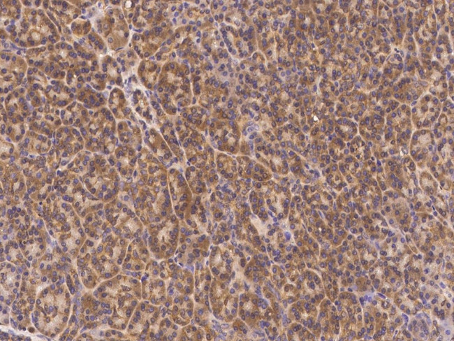 PMVK Antibody in Immunohistochemistry (Paraffin) (IHC (P))