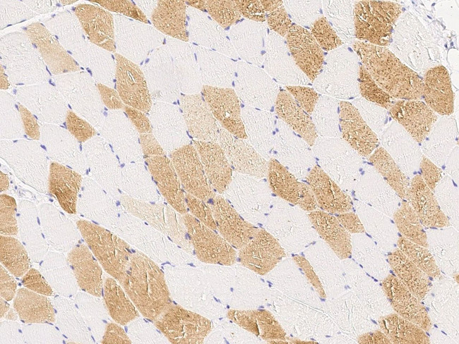 PMVK Antibody in Immunohistochemistry (Paraffin) (IHC (P))