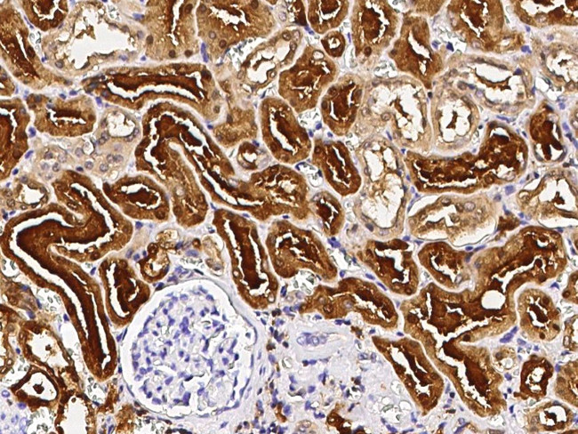 PNP Antibody in Immunohistochemistry (Paraffin) (IHC (P))