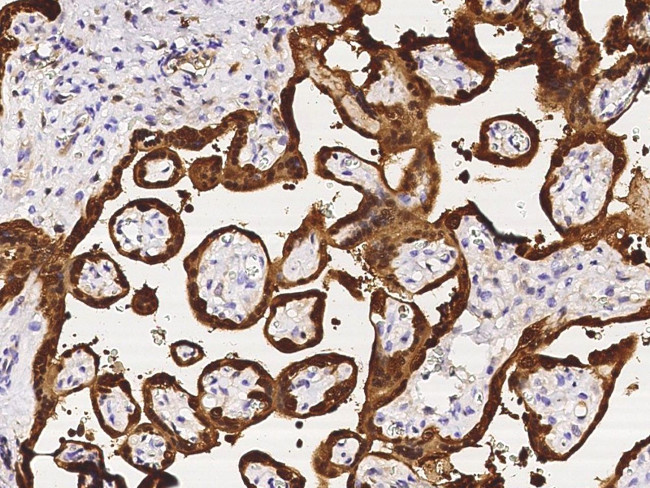 PNP Antibody in Immunohistochemistry (Paraffin) (IHC (P))