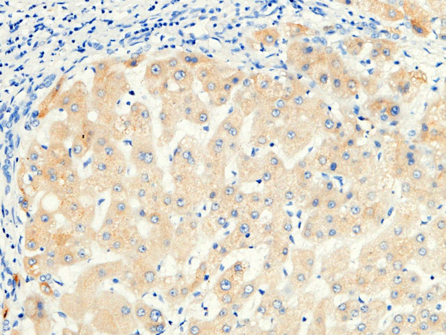 RBP4 Antibody in Immunohistochemistry (Paraffin) (IHC (P))