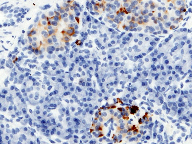 RBP4 Antibody in Immunohistochemistry (Paraffin) (IHC (P))