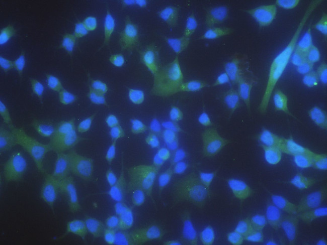 PPM1A Antibody in Immunocytochemistry (ICC/IF)