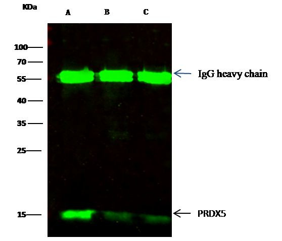 PRDX5 Antibody in Immunoprecipitation (IP)