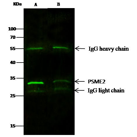 PSME2 Antibody in Immunoprecipitation (IP)