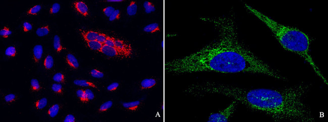 PTP1B Antibody in Immunocytochemistry (ICC/IF)