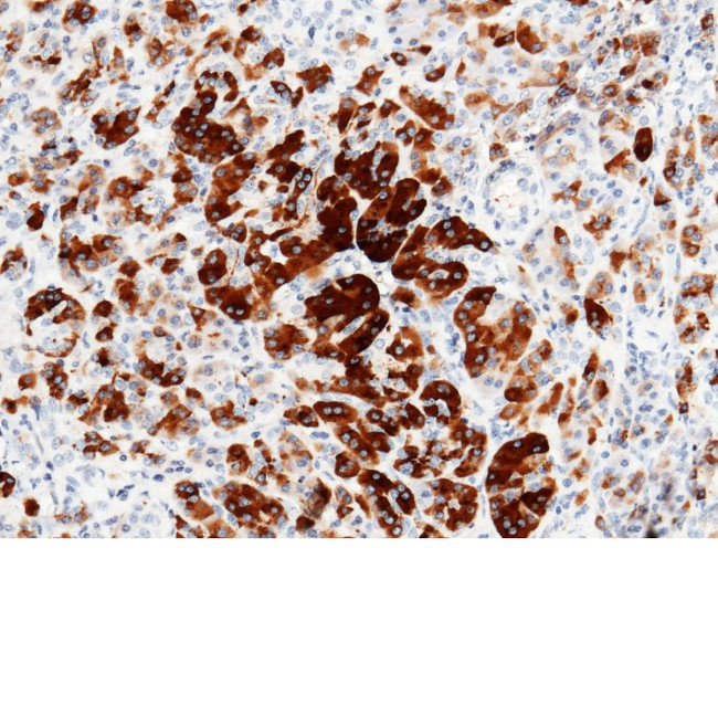 REG3A Antibody in Immunohistochemistry (Paraffin) (IHC (P))