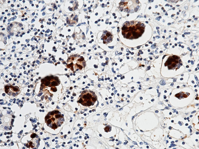 REG3A Antibody in Immunohistochemistry (Paraffin) (IHC (P))