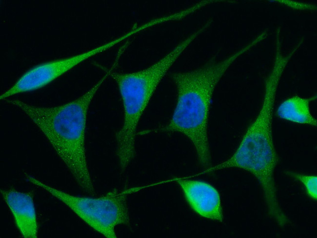 Renin Antibody in Immunocytochemistry (ICC/IF)