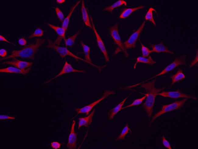 RRM1 Antibody in Immunocytochemistry (ICC/IF)