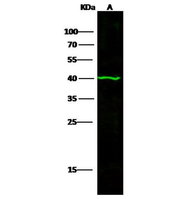 p53R2 Antibody in Western Blot (WB)