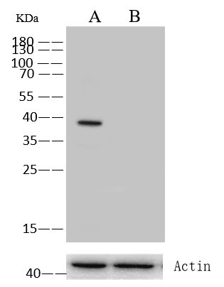 p53R2 Antibody in Western Blot (WB)