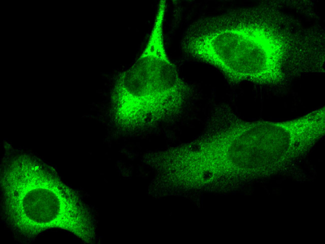 p53R2 Antibody in Immunocytochemistry (ICC/IF)