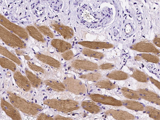 p53R2 Antibody in Immunohistochemistry (Paraffin) (IHC (P))