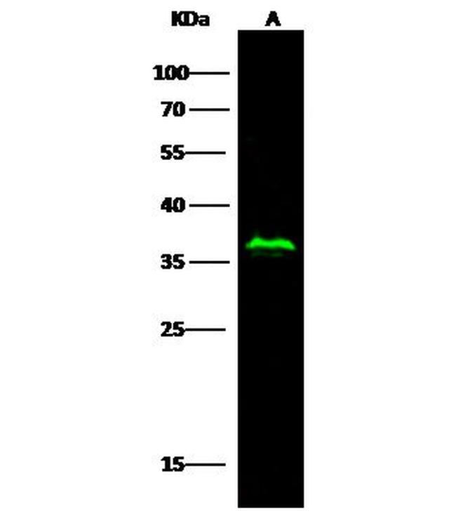 p53R2 Antibody in Western Blot (WB)