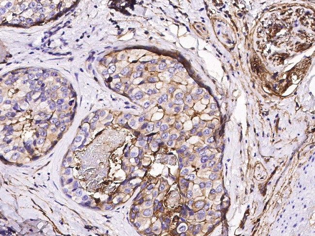 S100A10 Antibody in Immunohistochemistry (Paraffin) (IHC (P))