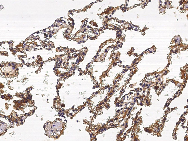 S100A10 Antibody in Immunohistochemistry (Paraffin) (IHC (P))