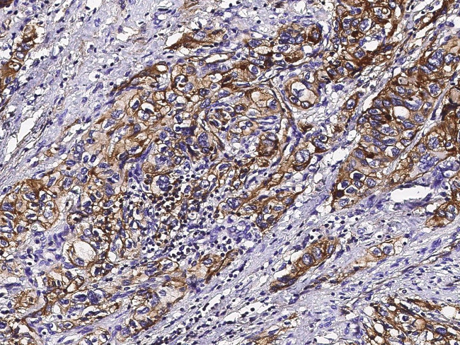 S100A10 Antibody in Immunohistochemistry (Paraffin) (IHC (P))