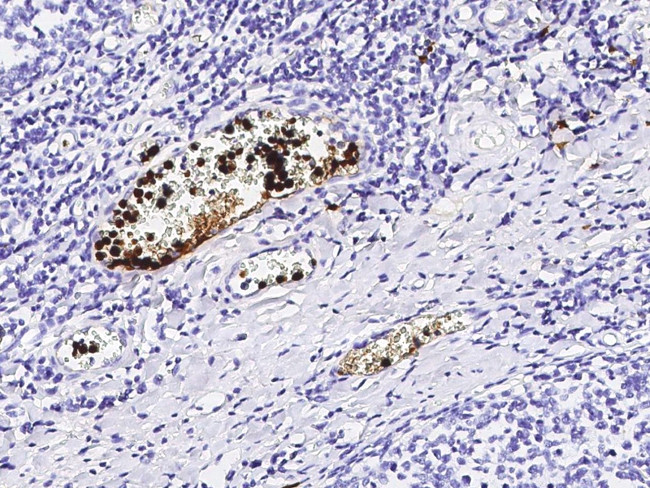 S100A12 Antibody in Immunohistochemistry (Paraffin) (IHC (P))