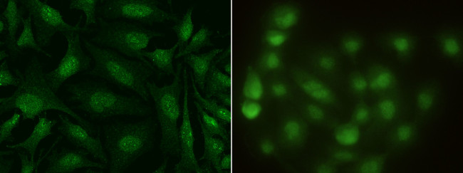 S100A13 Antibody in Immunocytochemistry (ICC/IF)