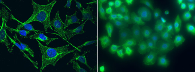 S100A5 Antibody in Immunocytochemistry (ICC/IF)