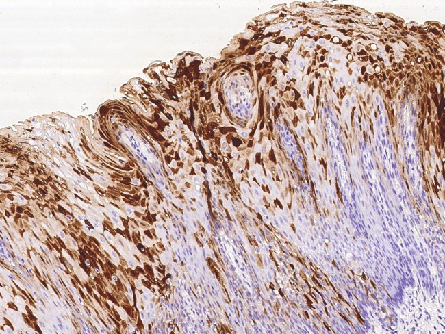 S100A7 Antibody in Immunohistochemistry (Paraffin) (IHC (P))