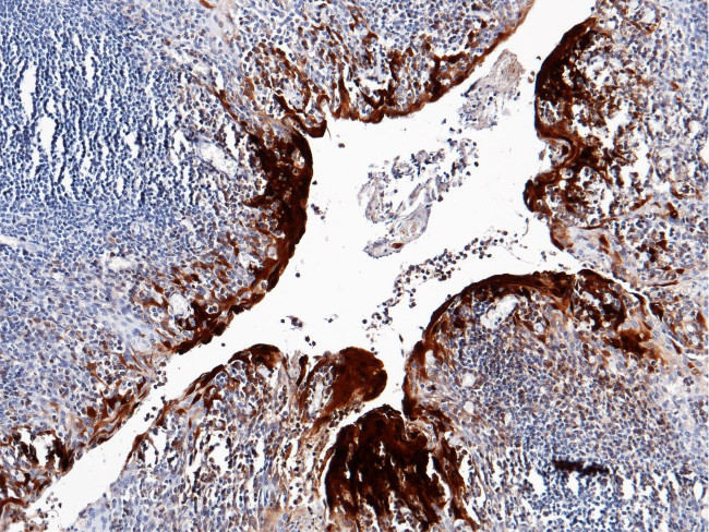 S100A7 Antibody in Immunohistochemistry (Paraffin) (IHC (P))