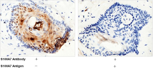 S100A7 Antibody in Immunohistochemistry (Paraffin) (IHC (P))