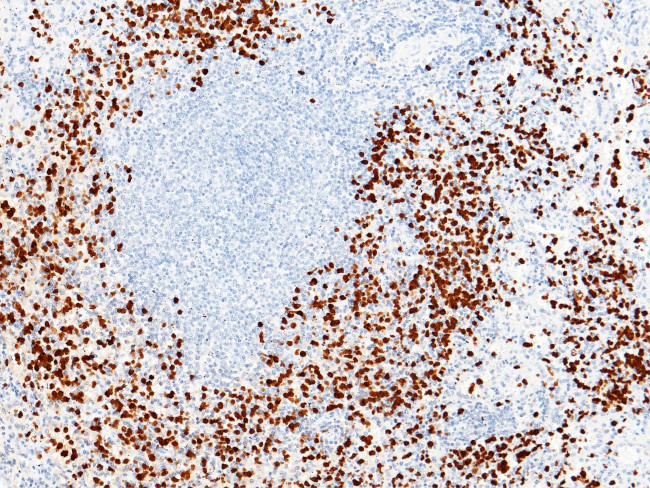 S100A9 Antibody in Immunohistochemistry (Paraffin) (IHC (P))