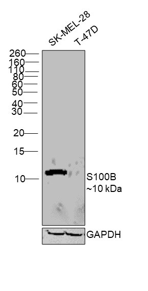 S100B Antibody in Western Blot (WB)